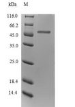 ITPA Protein - (Tris-Glycine gel) Discontinuous SDS-PAGE (reduced) with 5% enrichment gel and 15% separation gel.