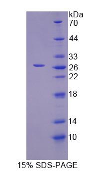 ITPA Protein - Recombinant  InosineTriphosphatase(ITPA) By SDS-PAGE