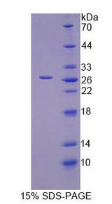 ITPA Protein - Recombinant  InosineTriphosphatase(ITPA) By SDS-PAGE