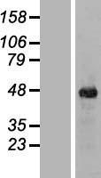 ITPK1 Protein - Western validation with an anti-DDK antibody * L: Control HEK293 lysate R: Over-expression lysate