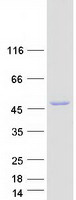 ITPK1 Protein - Purified recombinant protein ITPK1 was analyzed by SDS-PAGE gel and Coomassie Blue Staining