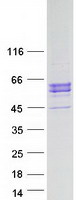 ITPKA Protein - Purified recombinant protein ITPKA was analyzed by SDS-PAGE gel and Coomassie Blue Staining