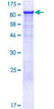 ITPKC Protein - 12.5% SDS-PAGE of human ITPKC stained with Coomassie Blue
