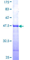 ITPKC Protein - 12.5% SDS-PAGE Stained with Coomassie Blue.