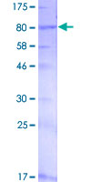ITPRIP Protein - 12.5% SDS-PAGE of human KIAA1754 stained with Coomassie Blue