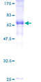IVD Protein - 12.5% SDS-PAGE of human IVD stained with Coomassie Blue