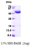 IVD Protein