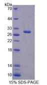 IVD Protein - Recombinant Isovaleryl Coenzyme A Dehydrogenase (IVD) by SDS-PAGE