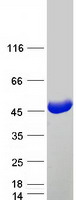 IVD Protein - Purified recombinant protein IVD was analyzed by SDS-PAGE gel and Coomassie Blue Staining