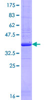 IVNS1ABP / NS1-BP Protein - 12.5% SDS-PAGE Stained with Coomassie Blue.