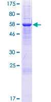 IYD Protein - 12.5% SDS-PAGE of human IYD stained with Coomassie Blue
