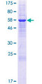 IYD Protein - 12.5% SDS-PAGE of human IYD stained with Coomassie Blue