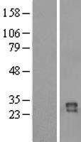 IZUMO4 Protein - Western validation with an anti-DDK antibody * L: Control HEK293 lysate R: Over-expression lysate