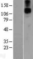 JAG1 / Jagged 1 Protein - Western validation with an anti-DDK antibody * L: Control HEK293 lysate R: Over-expression lysate
