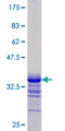 JAG1 / Jagged 1 Protein - 12.5% SDS-PAGE Stained with Coomassie Blue.