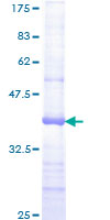 JAG2 / Jagged-2 Protein - 12.5% SDS-PAGE Stained with Coomassie Blue.