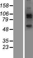 JAKMIP2 Protein - Western validation with an anti-DDK antibody * L: Control HEK293 lysate R: Over-expression lysate