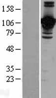 JAM2 Protein - Western validation with an anti-DDK antibody * L: Control HEK293 lysate R: Over-expression lysate