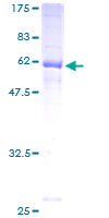 JAM2 Protein - 12.5% SDS-PAGE of human JAM2 stained with Coomassie Blue