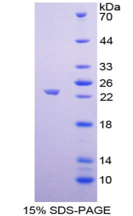 JAM2 Protein - Recombinant  Junctional Adhesion Molecule 2 By SDS-PAGE