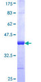 JARID2 / JMJ Protein - 12.5% SDS-PAGE Stained with Coomassie Blue.