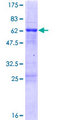 JAZF1 Protein - 12.5% SDS-PAGE of human JAZF1 stained with Coomassie Blue