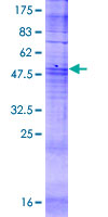 JCG1 / OR5P3 Protein - 12.5% SDS-PAGE of human OR5P3 stained with Coomassie Blue
