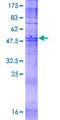 JCG1 / OR5P3 Protein - 12.5% SDS-PAGE of human OR5P3 stained with Coomassie Blue