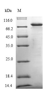 JCHAIN / Ig J Chain Protein - (Tris-Glycine gel) Discontinuous SDS-PAGE (reduced) with 5% enrichment gel and 15% separation gel.