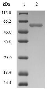 JCHAIN / Ig J Chain Protein - (Tris-Glycine gel) Discontinuous SDS-PAGE (reduced) with 5% enrichment gel and 15% separation gel.