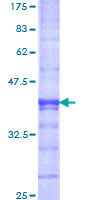 JHDM1A / KDM2A Protein - 12.5% SDS-PAGE Stained with Coomassie Blue.