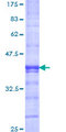 JHDM1A / KDM2A Protein - 12.5% SDS-PAGE Stained with Coomassie Blue.