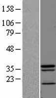 JKAMP Protein - Western validation with an anti-DDK antibody * L: Control HEK293 lysate R: Over-expression lysate
