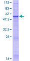 JKAMP Protein - 12.5% SDS-PAGE of human C14orf100 stained with Coomassie Blue