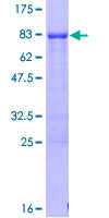 JMJD6 / PSR Protein - 12.5% SDS-PAGE of human PTDSR stained with Coomassie Blue
