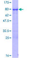 JMJD6 / PSR Protein - 12.5% SDS-PAGE of human PTDSR stained with Coomassie Blue