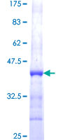 JMJD6 / PSR Protein - 12.5% SDS-PAGE Stained with Coomassie Blue.