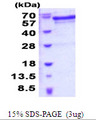 JMJD6 / PSR Protein