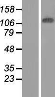 JMJD7 Protein - Western validation with an anti-DDK antibody * L: Control HEK293 lysate R: Over-expression lysate