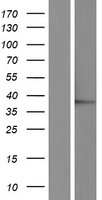 JMJD7 Protein - Western validation with an anti-DDK antibody * L: Control HEK293 lysate R: Over-expression lysate