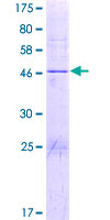 JOSD1 Protein - 12.5% SDS-PAGE of human JOSD1 stained with Coomassie Blue
