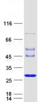 JOSD1 Protein - Purified recombinant protein JOSD1 was analyzed by SDS-PAGE gel and Coomassie Blue Staining