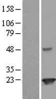 JOSD2 Protein - Western validation with an anti-DDK antibody * L: Control HEK293 lysate R: Over-expression lysate