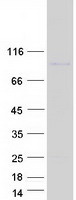 JPH4 Protein - Purified recombinant protein JPH4 was analyzed by SDS-PAGE gel and Coomassie Blue Staining