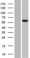 JRK Protein - Western validation with an anti-DDK antibody * L: Control HEK293 lysate R: Over-expression lysate