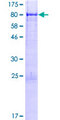 JRK Protein - 12.5% SDS-PAGE of human JRK stained with Coomassie Blue
