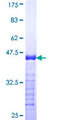 JRKL Protein - 12.5% SDS-PAGE Stained with Coomassie Blue
