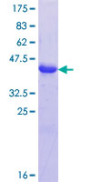 JSRP1 Protein - 12.5% SDS-PAGE Stained with Coomassie Blue.