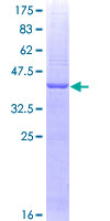 JTB / PAR Protein - 12.5% SDS-PAGE of human JTB stained with Coomassie Blue