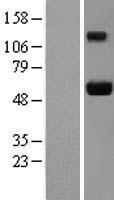 JUB / Ajuba Protein - Western validation with an anti-DDK antibody * L: Control HEK293 lysate R: Over-expression lysate